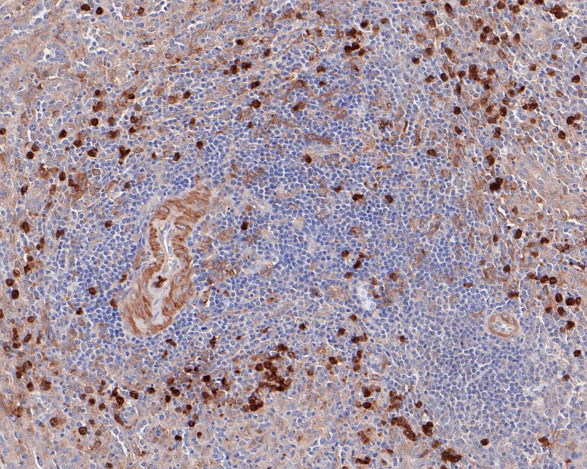 Immunohistochemical analysis of paraffin-embedded human spleen tissue using anti-NOXA2 antibody. The section was pre-treated using heat mediated antigen retrieval with Tris-EDTA buffer (pH 8.0-8.4) for 20 minutes.The tissues were blocked in 5% BSA for 30 minutes at room temperature, washed with ddH2O and PBS, and then probed with the primary antibody (ET7108-72, 1/50) for 30 minutes at room temperature. The detection was performed using an HRP conjugated compact polymer system. DAB was used as the chromogen. Tissues were counterstained with hematoxylin and mounted with DPX.