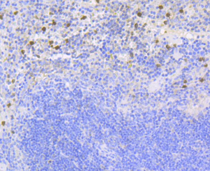Immunohistochemical analysis of paraffin-embedded mouse spleen tissue using anti-NOXA2 antibody. The section was pre-treated using heat mediated antigen retrieval with Tris-EDTA buffer (pH 8.0-8.4) for 20 minutes.The tissues were blocked in 5% BSA for 30 minutes at room temperature, washed with ddH2O and PBS, and then probed with the primary antibody (ET7108-72, 1/50) for 30 minutes at room temperature. The detection was performed using an HRP conjugated compact polymer system. DAB was used as the chromogen. Tissues were counterstained with hematoxylin and mounted with DPX.