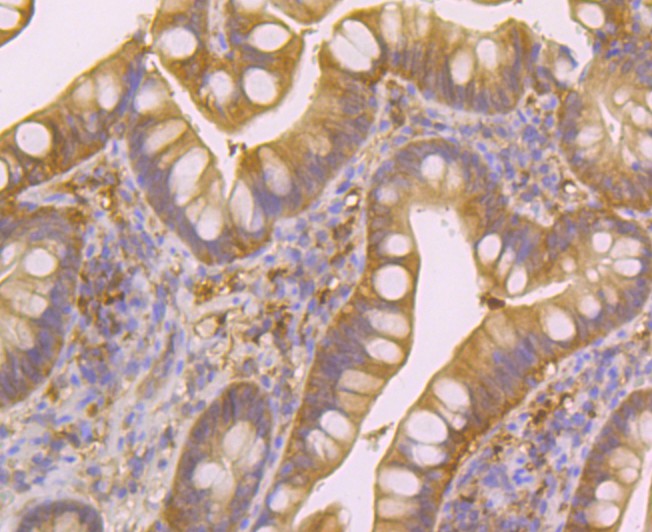 Immunohistochemical analysis of paraffin-embedded  human small intestine tissue with Rabbit anti-Nudel antibody (ET7108-73) at 1/50 dilution.<br />
<br />
The section was pre-treated using heat mediated antigen retrieval with Tris-EDTA buffer (pH 8.0-8.4) for 20 minutes. The tissues were blocked in 1% BSA for 20 minutes at room temperature, washed with ddH2O and PBS, and then probed with the primary antibody (ET7108-73) at 1/50 dilution for 1 hour at room temperature. The detection was performed using an HRP conjugated compact polymer system. DAB was used as the chromogen. Tissues were counterstained with hematoxylin and mounted with DPX.