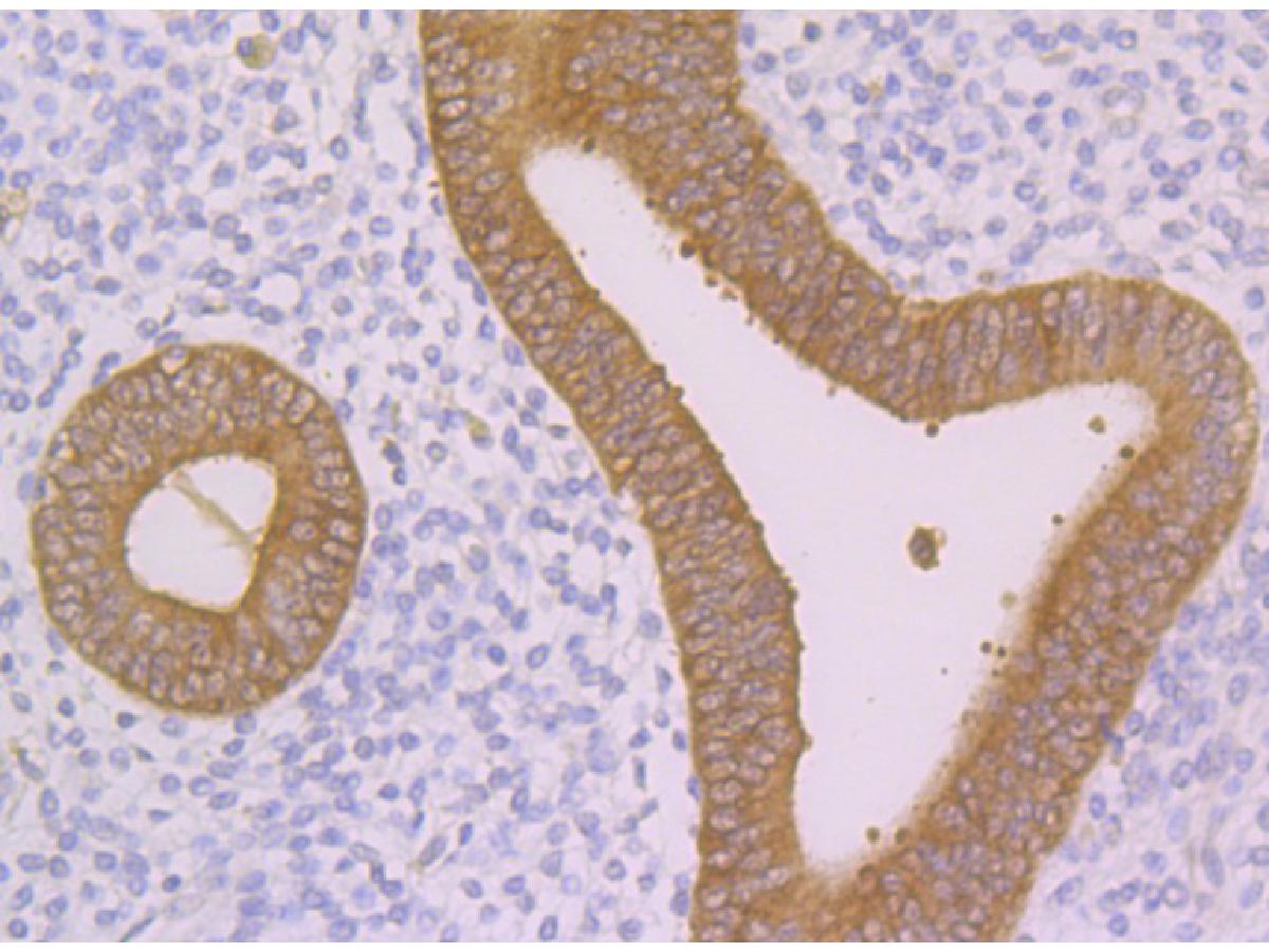 Immunohistochemical analysis of paraffin-embedded  human uterus tissue with Rabbit anti-Nudel antibody (ET7108-73) at 1/50 dilution.<br />
<br />
The section was pre-treated using heat mediated antigen retrieval with Tris-EDTA buffer (pH 8.0-8.4) for 20 minutes. The tissues were blocked in 1% BSA for 20 minutes at room temperature, washed with ddH2O and PBS, and then probed with the primary antibody (ET7108-73) at 1/50 dilution for 1 hour at room temperature. The detection was performed using an HRP conjugated compact polymer system. DAB was used as the chromogen. Tissues were counterstained with hematoxylin and mounted with DPX.