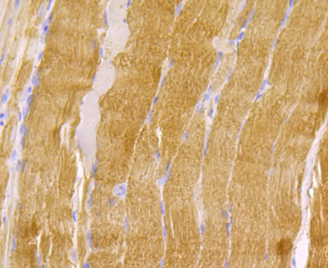 Immunohistochemical analysis of paraffin-embedded rat smooth muscle tissue using anti-Tropomyosin 1 antibody. The section was pre-treated using heat mediated antigen retrieval with Tris-EDTA buffer (pH 8.0-8.4) for 20 minutes.The tissues were blocked in 5% BSA for 30 minutes at room temperature, washed with ddH2O and PBS, and then probed with the primary antibody (ET7108-74, 1/50) for 30 minutes at room temperature. The detection was performed using an HRP conjugated compact polymer system. DAB was used as the chromogen. Tissues were counterstained with hematoxylin and mounted with DPX.