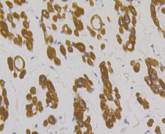 Immunohistochemical analysis of paraffin-embedded human heart tissue using anti-Tropomyosin 1 antibody. The section was pre-treated using heat mediated antigen retrieval with Tris-EDTA buffer (pH 8.0-8.4) for 20 minutes.The tissues were blocked in 5% BSA for 30 minutes at room temperature, washed with ddH2O and PBS, and then probed with the primary antibody (ET7108-74, 1/50) for 30 minutes at room temperature. The detection was performed using an HRP conjugated compact polymer system. DAB was used as the chromogen. Tissues were counterstained with hematoxylin and mounted with DPX.