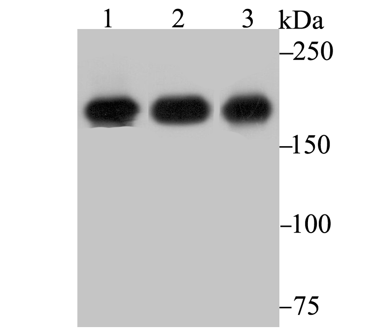 Western blot analysis of IQGAP1 on different lysates. Proteins were transferred to a PVDF membrane and blocked with 5% BSA in PBS for 1 hour at room temperature. The primary antibody (ET7108-79, 1/500) was used in 5% BSA at room temperature for 2 hours. Goat Anti-Rabbit IgG - HRP Secondary Antibody (HA1001) at 1:200,000 dilution was used for 1 hour at room temperature.<br />
Positive control: <br />
Lane 1: HUVEC cell lysate<br />
Lane 2: A431 cell lysate<br />
Lane 3: Mouse placenta tissue lysate