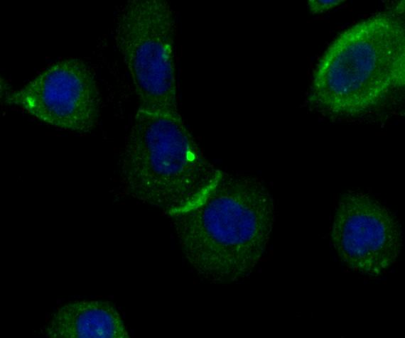 ICC staining of IQGAP1 in A431 cells (green). Formalin fixed cells were permeabilized with 0.1% Triton X-100 in TBS for 10 minutes at room temperature and blocked with 10% negative goat serum for 15 minutes at room temperature. Cells were probed with the primary antibody (ET7108-79, 1/50) for 1 hour at room temperature, washed with PBS. Alexa Fluor®488 conjugate-Goat anti-Rabbit IgG was used as the secondary antibody at 1/1,000 dilution. The nuclear counter stain is DAPI (blue).