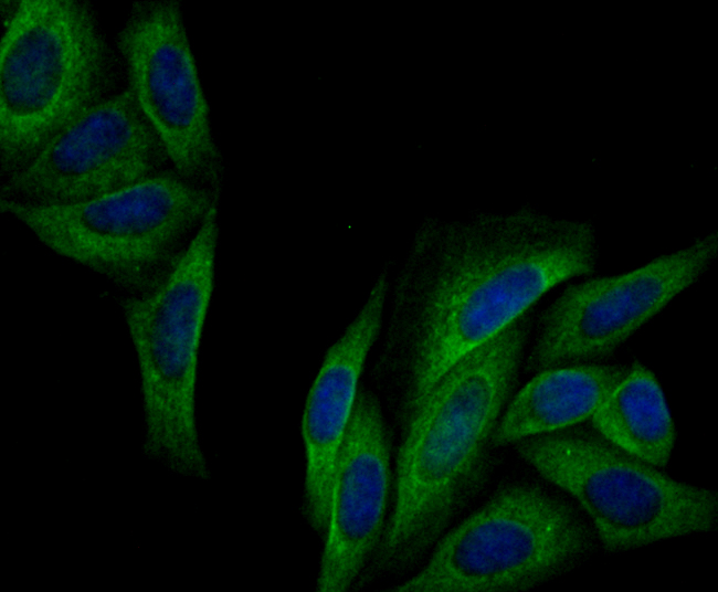 ICC staining of IQGAP1 in SiHa cells (green). Formalin fixed cells were permeabilized with 0.1% Triton X-100 in TBS for 10 minutes at room temperature and blocked with 10% negative goat serum for 15 minutes at room temperature. Cells were probed with the primary antibody (ET7108-79, 1/50) for 1 hour at room temperature, washed with PBS. Alexa Fluor®488 conjugate-Goat anti-Rabbit IgG was used as the secondary antibody at 1/1,000 dilution. The nuclear counter stain is DAPI (blue).