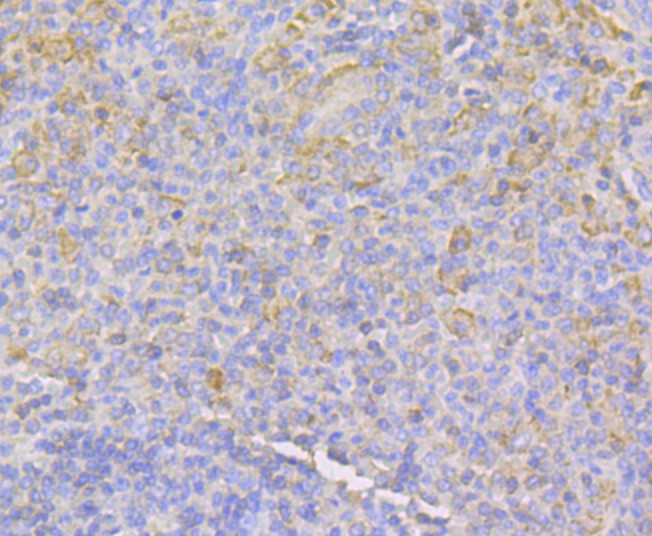 Immunohistochemical analysis of paraffin-embedded human spleen tissue using anti-IQGAP1 antibody. The section was pre-treated using heat mediated antigen retrieval with Tris-EDTA buffer (pH 9.0) for 20 minutes.The tissues were blocked in 1% BSA for 30 minutes at room temperature, washed with ddH2O and PBS, and then probed with the primary antibody (ET7108-79, 1/50) for 30 minutes at room temperature. The detection was performed using an HRP conjugated compact polymer system. DAB was used as the chromogen. Tissues were counterstained with hematoxylin and mounted with DPX.