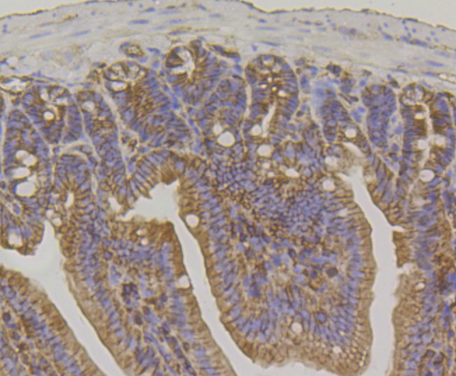 Immunohistochemical analysis of paraffin-embedded mouse colon tissue using anti-IQGAP1 antibody. The section was pre-treated using heat mediated antigen retrieval with Tris-EDTA buffer (pH 9.0) for 20 minutes.The tissues were blocked in 1% BSA for 30 minutes at room temperature, washed with ddH2O and PBS, and then probed with the primary antibody (ET7108-79, 1/50) for 30 minutes at room temperature. The detection was performed using an HRP conjugated compact polymer system. DAB was used as the chromogen. Tissues were counterstained with hematoxylin and mounted with DPX.