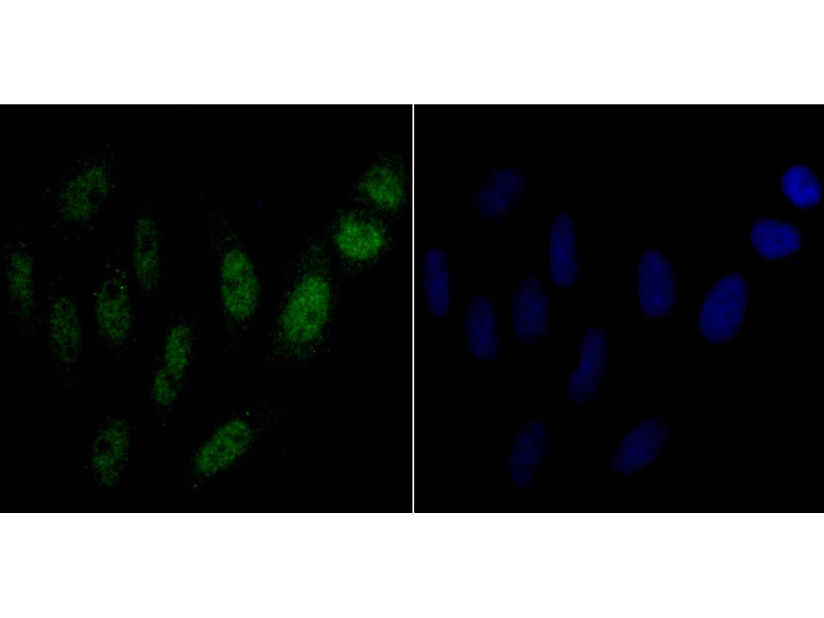 ICC staining p54nrb in SiHa cells (green). The nuclear counter stain is DAPI (blue). Cells were fixed in paraformaldehyde, permeabilised with 0.25% Triton X100/PBS.
