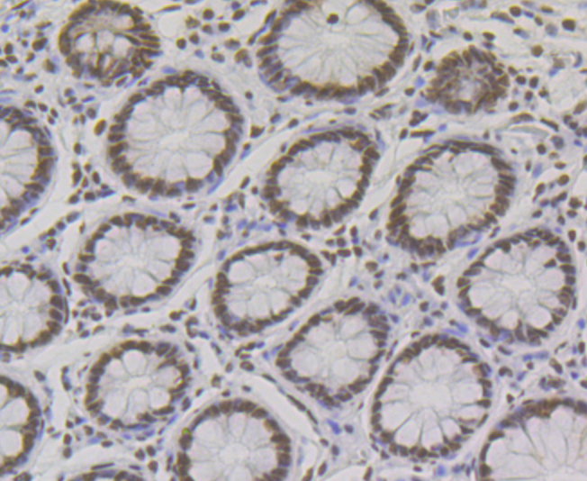 Immunohistochemical analysis of paraffin-embedded human colon tissue using anti- p54nrb antibody. Counter stained with hematoxylin.