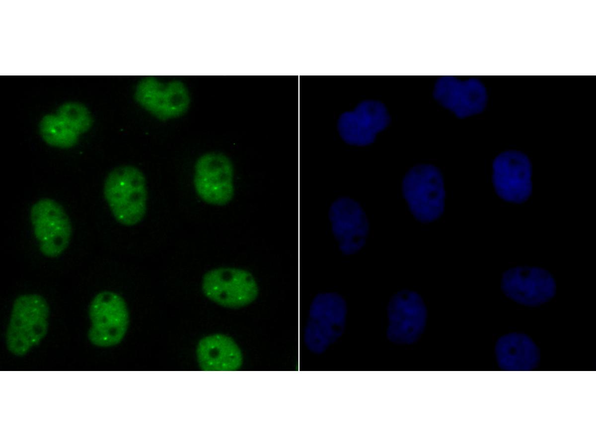 ICC staining Bub3 in A431 cells (green). The nuclear counter stain is DAPI (blue). Cells were fixed in paraformaldehyde, permeabilised with 0.25% Triton X100/PBS.