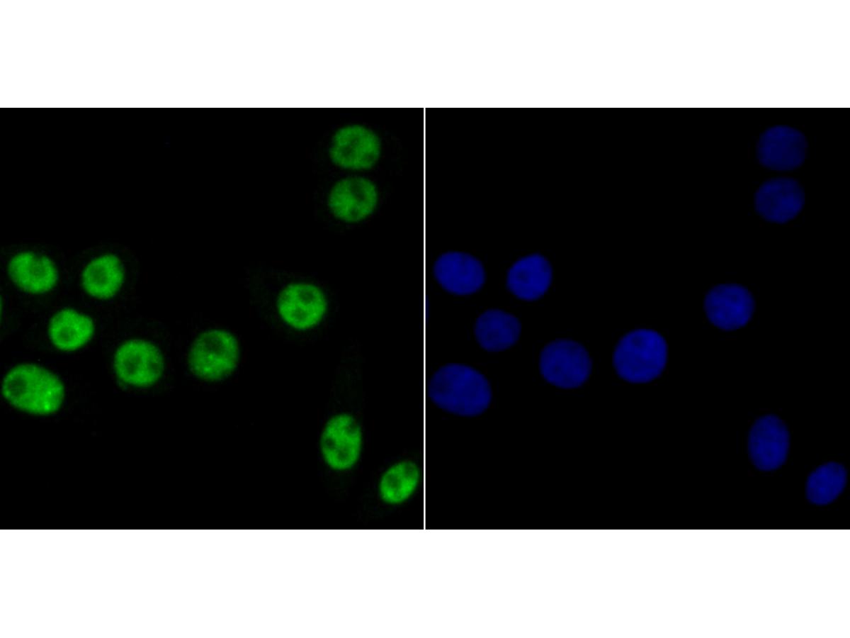 ICC staining Bub3 in LOVO cells (green). The nuclear counter stain is DAPI (blue). Cells were fixed in paraformaldehyde, permeabilised with 0.25% Triton X100/PBS.