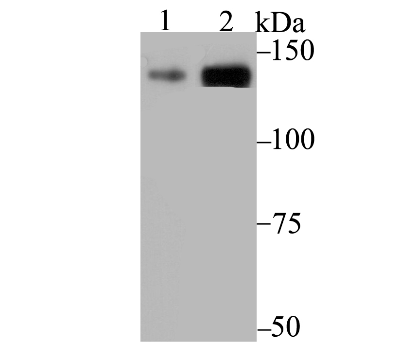 Western blot analysis of p150 CAF1 on K562 (1) and A431 (2) cell lysate using anti-p150 CAF1 antibody at 1/1,000 dilution.