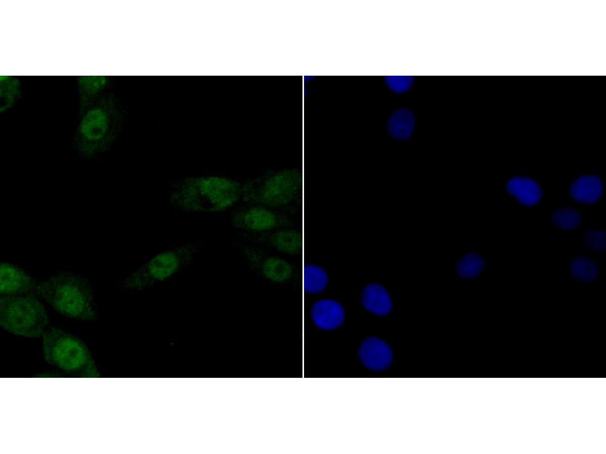 ICC staining p150 CAF1 in LOVO cells (green). The nuclear counter stain is DAPI (blue). Cells were fixed in paraformaldehyde, permeabilised with 0.25% Triton X100/PBS.