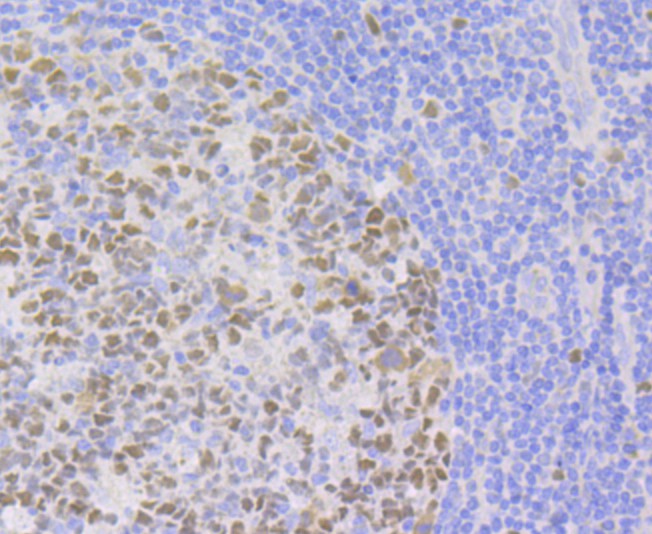 Immunohistochemical analysis of paraffin-embedded human tonsil tissue using anti-p150 CAF1 antibody. Counter stained with hematoxylin.
