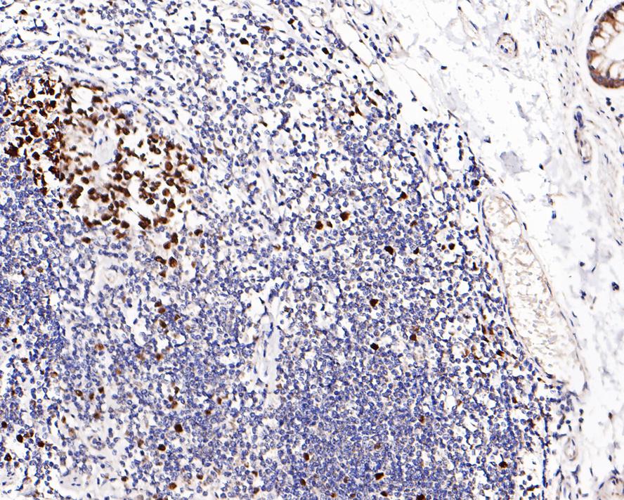 Immunohistochemical analysis of paraffin-embedded human colon tissue using anti-p150 CAF1 antibody. Counter stained with hematoxylin.