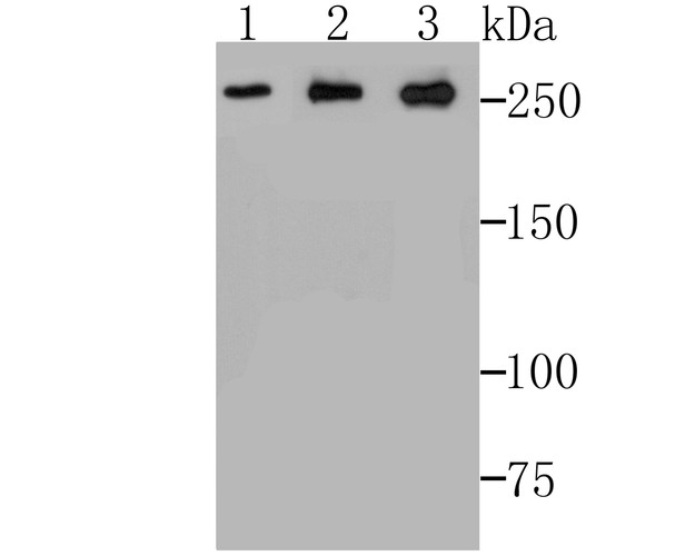 Western blot analysis of ADAMTS13 on different lysates. Proteins were transferred to a PVDF membrane and blocked with 5% BSA in PBS for 1 hour at room temperature. The primary antibody (ET7108-86, 1/500) was used in 5% BSA at room temperature for 2 hours. Goat Anti-Rabbit IgG - HRP Secondary Antibody (HA1001) at 1:5,000 dilution was used for 1 hour at room temperature.<br />
Positive control: <br />
Lane 1: SiHa cell lysate<br />
Lane 2: PC-3M cell lysate<br />
Lane 3: A549 cell lysate