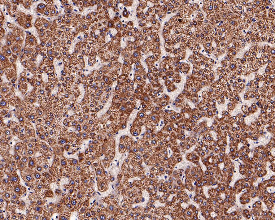 Immunohistochemical analysis of paraffin-embedded human liver tissue using anti-ADAMTS13 antibody. The section was pre-treated using heat mediated antigen retrieval with Tris-EDTA buffer (pH 8.0-8.4) for 20 minutes.The tissues were blocked in 5% BSA for 30 minutes at room temperature, washed with ddH2O and PBS, and then probed with the primary antibody (ET7108-86, 1/50) for 30 minutes at room temperature. The detection was performed using an HRP conjugated compact polymer system. DAB was used as the chromogen. Tissues were counterstained with hematoxylin and mounted with DPX.