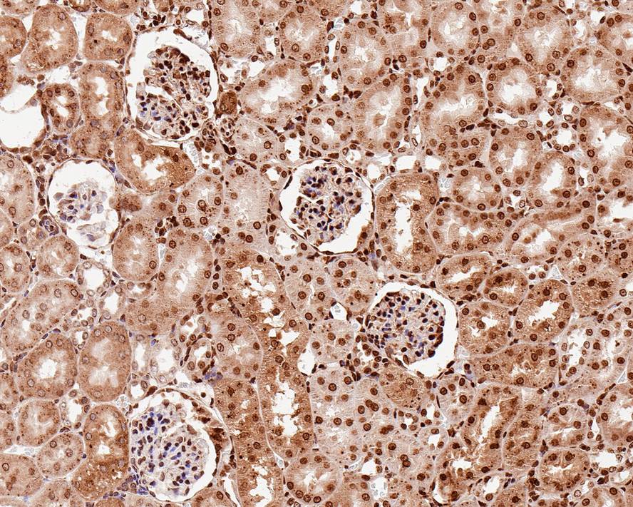 Immunohistochemical analysis of paraffin-embedded rat kidney tissue using anti-CBFb antibody. Counter stained with hematoxylin.