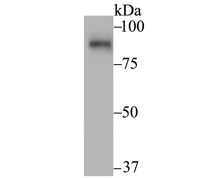 Western blot analysis of SUN1 on rat kidney tissue lysates. Proteins were transferred to a PVDF membrane and blocked with 5% BSA in PBS for 1 hour at room temperature. The primary antibody (ET7108-91, 1/500) was used in 5% BSA at room temperature for 2 hours. Goat Anti-Rabbit IgG - HRP Secondary Antibody (HA1001) at 1:200,000 dilution was used for 1 hour at room temperature.