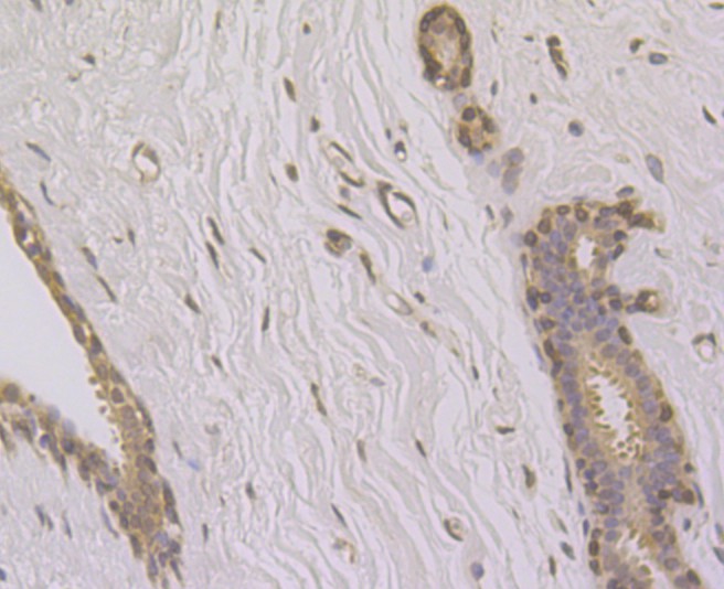Immunohistochemical analysis of paraffin-embedded human breast tissue using anti-SUN1 antibody. The section was pre-treated using heat mediated antigen retrieval with Tris-EDTA buffer (pH 9.0) for 20 minutes.The tissues were blocked in 1% BSA for 30 minutes at room temperature, washed with ddH2O and PBS, and then probed with the primary antibody (ET7108-91, 1/50) for 30 minutes at room temperature. The detection was performed using an HRP conjugated compact polymer system. DAB was used as the chromogen. Tissues were counterstained with hematoxylin and mounted with DPX.
