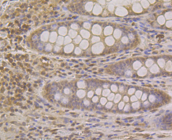 Immunohistochemical analysis of paraffin-embedded human colon tissue using anti-SUN1 antibody. The section was pre-treated using heat mediated antigen retrieval with Tris-EDTA buffer (pH 9.0) for 20 minutes.The tissues were blocked in 1% BSA for 30 minutes at room temperature, washed with ddH2O and PBS, and then probed with the primary antibody (ET7108-91, 1/50) for 30 minutes at room temperature. The detection was performed using an HRP conjugated compact polymer system. DAB was used as the chromogen. Tissues were counterstained with hematoxylin and mounted with DPX.