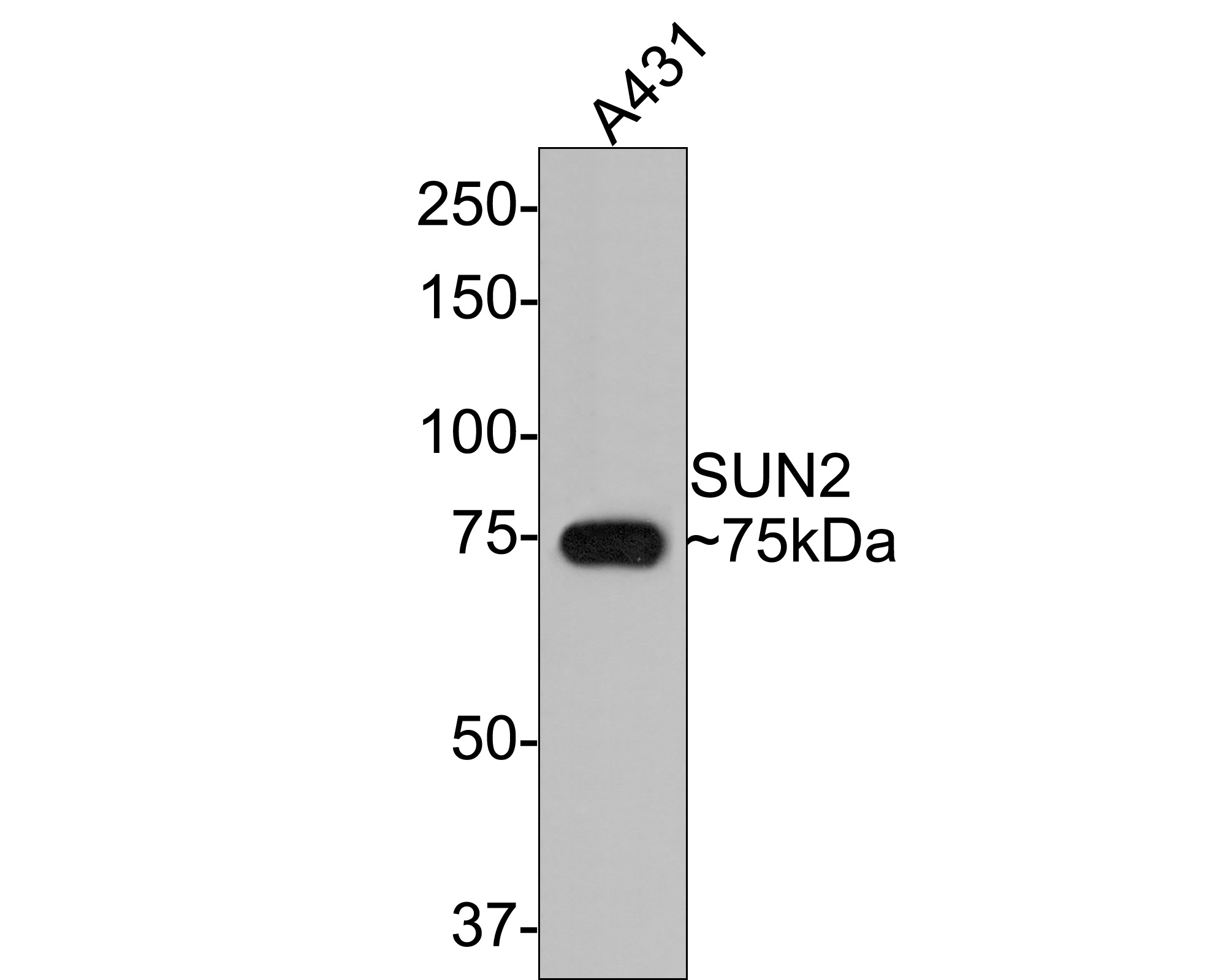 Western blot analysis of SUN2 on A431 cell lysates with Rabbit anti-SUN2 antibody (ET7108-92) at 1/500 dilution.<br />
<br />
Lysates/proteins at 10 µg/Lane.<br />
<br />
Predicted band size: 80 kDa<br />
Observed band size: 75 kDa<br />
<br />
Exposure time: 2 minutes;<br />
<br />
8% SDS-PAGE gel.<br />
<br />
Proteins were transferred to a PVDF membrane and blocked with 5% NFDM/TBST for 1 hour at room temperature. The primary antibody (ET7108-92) at 1/500 dilution was used in 5% NFDM/TBST at room temperature for 2 hours. Goat Anti-Rabbit IgG - HRP Secondary Antibody (HA1001) at 1:300,000 dilution was used for 1 hour at room temperature.