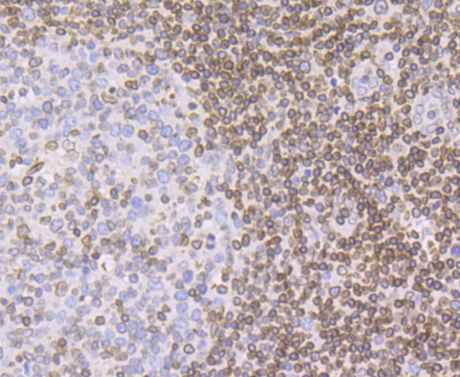 Immunohistochemical analysis of paraffin-embedded human tonsil tissue using anti-SUN2 antibody. Counter stained with hematoxylin.