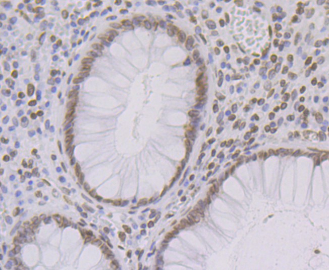 Immunohistochemical analysis of paraffin-embedded human colon tissue using anti-SUN2 antibody. Counter stained with hematoxylin.