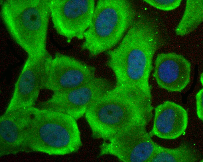 ICC staining FKBP52 in MCF-7 cells (green). The nuclear counter stain is DAPI (blue). Cells were fixed in paraformaldehyde, permeabilised with 0.25% Triton X100/PBS.