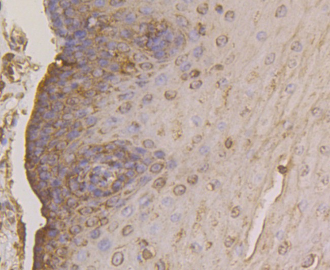 Immunohistochemical analysis of paraffin-embedded human esophagus tissue using anti-FKBP52 antibody. Counter stained with hematoxylin.