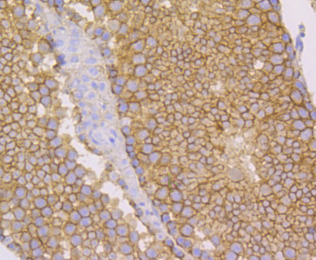 Immunohistochemical analysis of paraffin-embedded mouse testis tissue using anti-Nectin 2 antibody. The section was pre-treated using heat mediated antigen retrieval with Tris-EDTA buffer (pH 8.0-8.4) for 20 minutes.The tissues were blocked in 5% BSA for 30 minutes at room temperature, washed with ddH2O and PBS, and then probed with the primary antibody (ET7108-95, 1/50) for 30 minutes at room temperature. The detection was performed using an HRP conjugated compact polymer system. DAB was used as the chromogen. Tissues were counterstained with hematoxylin and mounted with DPX.