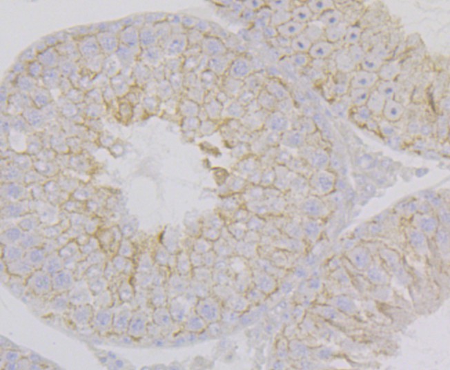 Immunohistochemical analysis of paraffin-embedded rat testis tissue using anti-Nectin 2 antibody. The section was pre-treated using heat mediated antigen retrieval with Tris-EDTA buffer (pH 8.0-8.4) for 20 minutes.The tissues were blocked in 5% BSA for 30 minutes at room temperature, washed with ddH2O and PBS, and then probed with the primary antibody (ET7108-95, 1/50) for 30 minutes at room temperature. The detection was performed using an HRP conjugated compact polymer system. DAB was used as the chromogen. Tissues were counterstained with hematoxylin and mounted with DPX.