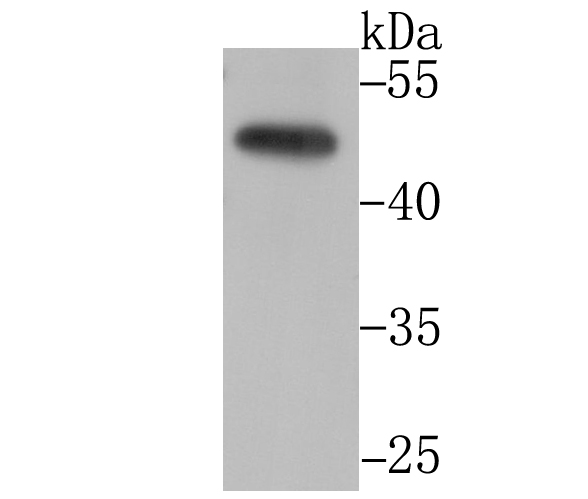 Western blot analysis of CtBP1 on PC-3M cell lysates. Proteins were transferred to a PVDF membrane and blocked with 5% BSA in PBS for 1 hour at room temperature. The primary antibody (ET7108-96, 1/500) was used in 5% BSA at room temperature for 2 hours. Goat Anti-Rabbit IgG - HRP Secondary Antibody (HA1001) at 1:200,000 dilution was used for 1 hour at room temperature.<br />
<br />
Predicted band size: 47 kDa<br />
Observed band size: 47 kDa