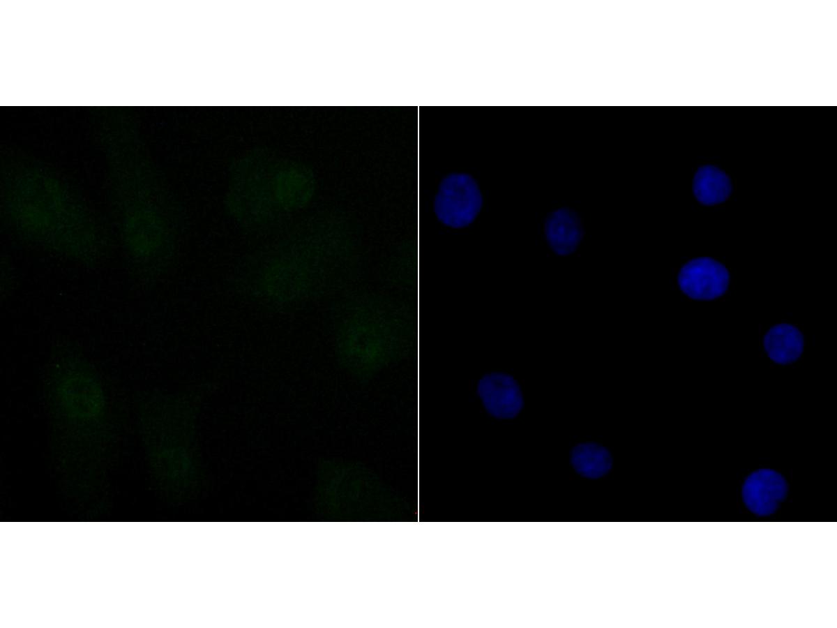 ICC staining of CtBP1 in A549 cells (green). Formalin fixed cells were permeabilized with 0.1% Triton X-100 in TBS for 10 minutes at room temperature and blocked with 10% negative goat serum for 15 minutes at room temperature. Cells were probed with the primary antibody (ET7108-96, 1/50) for 1 hour at room temperature, washed with PBS. Alexa Fluor®488 conjugate-Goat anti-Rabbit IgG was used as the secondary antibody at 1/1,000 dilution. The nuclear counter stain is DAPI (blue).
