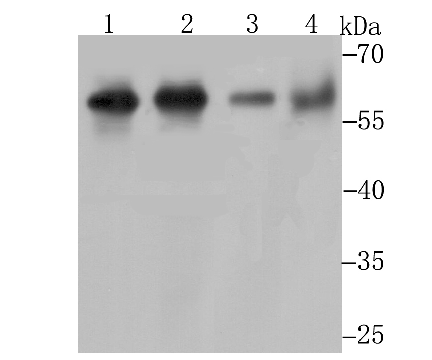 Western blot analysis of Methionine Aminopeptidase 2 on different lysates. Proteins were transferred to a PVDF membrane and blocked with 5% BSA in PBS for 1 hour at room temperature. The primary antibody (ET7108-97, 1/500) was used in 5% BSA at room temperature for 2 hours. Goat Anti-Rabbit IgG - HRP Secondary Antibody (HA1001) at 1:200,000 dilution was used for 1 hour at room temperature.<br />
Positive control: <br />
Lane 1: Daudi cell lysate<br />
Lane 2: K562 cell lysate<br />
Lane 3: Mouse thymus tissue lysate<br />
Lane 4: Mouse kidney tissue lysate