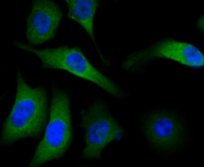 ICC staining of Methionine Aminopeptidase 2 in PC-3M cells (green). Formalin fixed cells were permeabilized with 0.1% Triton X-100 in TBS for 10 minutes at room temperature and blocked with 1% Blocker BSA for 15 minutes at room temperature. Cells were probed with the primary antibody (ET7108-97, 1/50) for 1 hour at room temperature, washed with PBS. Alexa Fluor®488 Goat anti-Rabbit IgG was used as the secondary antibody at 1/1,000 dilution. The nuclear counter stain is DAPI (blue).