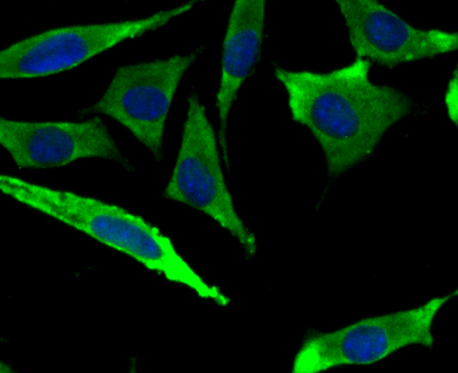 ICC staining of Methionine Aminopeptidase 2 in SH-SY5Y cells (green). Formalin fixed cells were permeabilized with 0.1% Triton X-100 in TBS for 10 minutes at room temperature and blocked with 1% Blocker BSA for 15 minutes at room temperature. Cells were probed with the primary antibody (ET7108-97, 1/50) for 1 hour at room temperature, washed with PBS. Alexa Fluor®488 Goat anti-Rabbit IgG was used as the secondary antibody at 1/1,000 dilution. The nuclear counter stain is DAPI (blue).