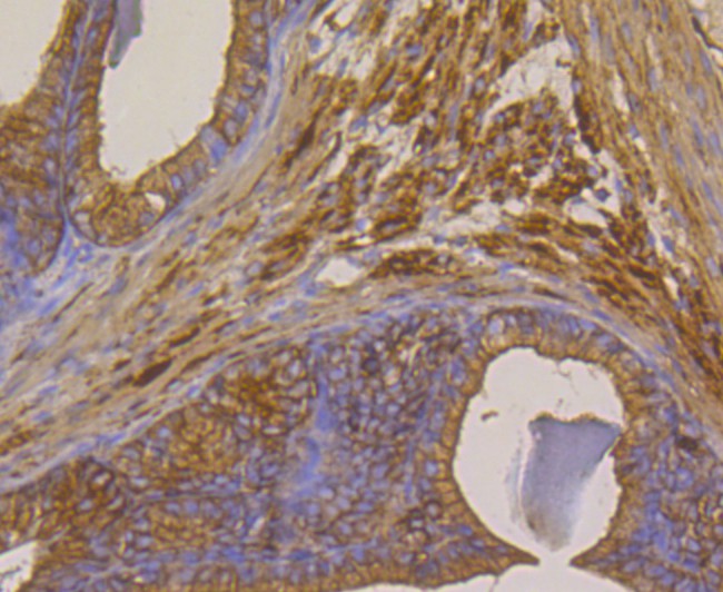 Immunohistochemical analysis of paraffin-embedded rat seminal vesicle tissue using anti-Methionine Aminopeptidase 2 antibody. The section was pre-treated using heat mediated antigen retrieval with Tris-EDTA buffer (pH 8.0-8.4) for 20 minutes.The tissues were blocked in 5% BSA for 30 minutes at room temperature, washed with ddH2O and PBS, and then probed with the primary antibody (ET7108-97, 1/50) for 30 minutes at room temperature. The detection was performed using an HRP conjugated compact polymer system. DAB was used as the chromogen. Tissues were counterstained with hematoxylin and mounted with DPX.