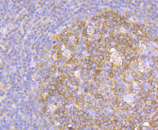 Immunohistochemical analysis of paraffin-embedded human tonsil tissue using anti-Methionine Aminopeptidase 2 antibody. The section was pre-treated using heat mediated antigen retrieval with Tris-EDTA buffer (pH 8.0-8.4) for 20 minutes.The tissues were blocked in 5% BSA for 30 minutes at room temperature, washed with ddH2O and PBS, and then probed with the primary antibody (ET7108-97, 1/50) for 30 minutes at room temperature. The detection was performed using an HRP conjugated compact polymer system. DAB was used as the chromogen. Tissues were counterstained with hematoxylin and mounted with DPX.