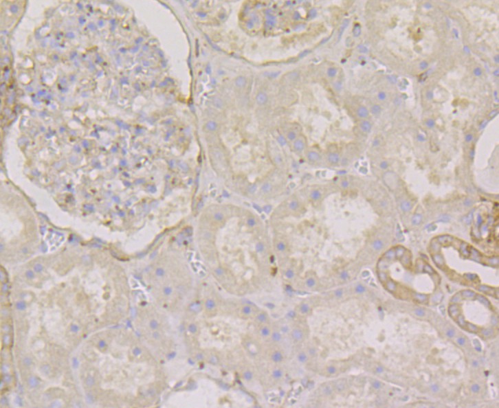 Immunohistochemical analysis of paraffin-embedded human kidney tissue using anti-Methionine Aminopeptidase 2 antibody. The section was pre-treated using heat mediated antigen retrieval with Tris-EDTA buffer (pH 8.0-8.4) for 20 minutes.The tissues were blocked in 5% BSA for 30 minutes at room temperature, washed with ddH2O and PBS, and then probed with the primary antibody (ET7108-97, 1/50) for 30 minutes at room temperature. The detection was performed using an HRP conjugated compact polymer system. DAB was used as the chromogen. Tissues were counterstained with hematoxylin and mounted with DPX.