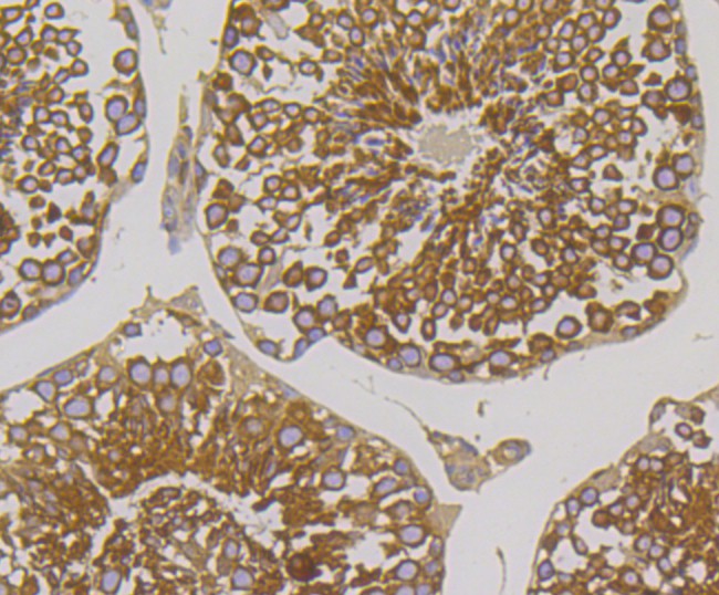 Immunohistochemical analysis of paraffin-embedded mouse testis tissue using anti-Methionine Aminopeptidase 2 antibody. The section was pre-treated using heat mediated antigen retrieval with Tris-EDTA buffer (pH 8.0-8.4) for 20 minutes.The tissues were blocked in 5% BSA for 30 minutes at room temperature, washed with ddH2O and PBS, and then probed with the primary antibody (ET7108-97, 1/50) for 30 minutes at room temperature. The detection was performed using an HRP conjugated compact polymer system. DAB was used as the chromogen. Tissues were counterstained with hematoxylin and mounted with DPX.