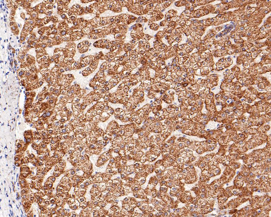 Immunohistochemical analysis of paraffin-embedded human liver tissue with Rabbit anti-Monoamine Oxidase B antibody (ET7108-98) at 1/500 dilution.<br />
<br />
The section was pre-treated using heat mediated antigen retrieval with Tris-EDTA buffer (pH 9.0) for 20 minutes. The tissues were blocked in 1% BSA for 20 minutes at room temperature, washed with ddH2O and PBS, and then probed with the primary antibody (ET7108-98) at 1/500 dilution for 1 hour at room temperature. The detection was performed using an HRP conjugated compact polymer system. DAB was used as the chromogen. Tissues were counterstained with hematoxylin and mounted with DPX.