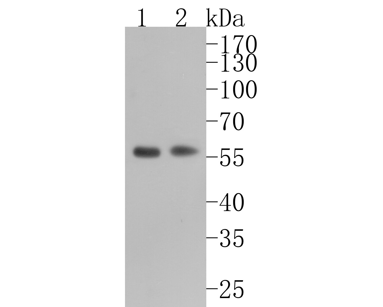 Western blot analysis of Retinoid X Receptor alpha on different lysates. Proteins were transferred to a PVDF membrane and blocked with 5% BSA in PBS for 1 hour at room temperature. The primary antibody (ET7108-99, 1/500) was used in 5% BSA at room temperature for 2 hours. Goat Anti-Rabbit IgG - HRP Secondary Antibody (HA1001) at 1:5,000 dilution was used for 1 hour at room temperature.<br />
Positive control: <br />
Lane 1: A549 cell lysate<br />
Lane 2: MCF-7 cell lysate
