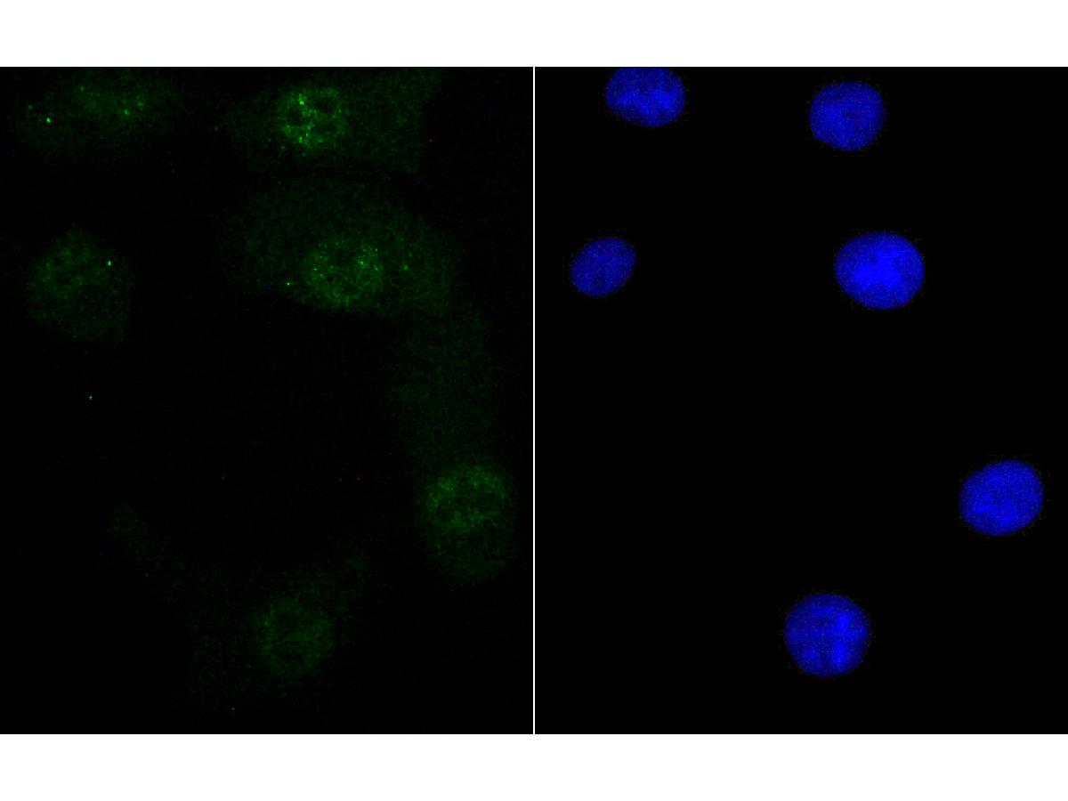 ICC staining of Retinoid X Receptor alpha in A549 cells (green). Formalin fixed cells were permeabilized with 0.1% Triton X-100 in TBS for 10 minutes at room temperature and blocked with 1% Blocker BSA for 15 minutes at room temperature. Cells were probed with the primary antibody (ET7108-99, 1/50) for 1 hour at room temperature, washed with PBS. Alexa Fluor®488 Goat anti-Rabbit IgG was used as the secondary antibody at 1/1,000 dilution. The nuclear counter stain is DAPI (blue).