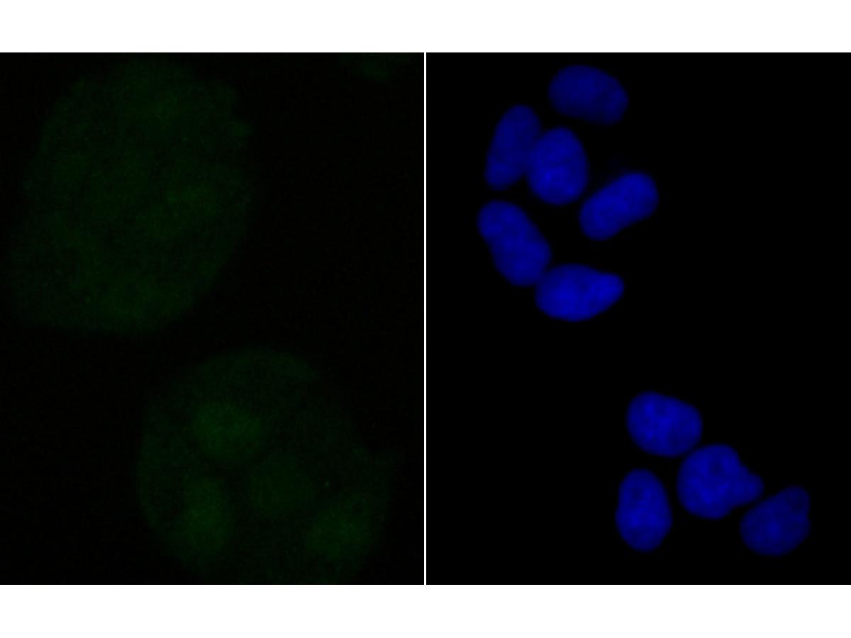 ICC staining of Retinoid X Receptor alpha in Hela cells (green). Formalin fixed cells were permeabilized with 0.1% Triton X-100 in TBS for 10 minutes at room temperature and blocked with 1% Blocker BSA for 15 minutes at room temperature. Cells were probed with the primary antibody (ET7108-99, 1/50) for 1 hour at room temperature, washed with PBS. Alexa Fluor®488 Goat anti-Rabbit IgG was used as the secondary antibody at 1/1,000 dilution. The nuclear counter stain is DAPI (blue).