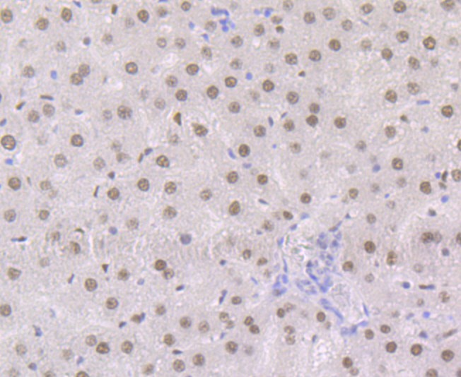 Immunohistochemical analysis of paraffin-embedded rat liver tissue using anti-Retinoid X Receptor alpha antibody. The section was pre-treated using heat mediated antigen retrieval with Tris-EDTA buffer (pH 8.0-8.4) for 20 minutes.The tissues were blocked in 5% BSA for 30 minutes at room temperature, washed with ddH2O and PBS, and then probed with the primary antibody (ET7108-99, 1/50) for 30 minutes at room temperature. The detection was performed using an HRP conjugated compact polymer system. DAB was used as the chromogen. Tissues were counterstained with hematoxylin and mounted with DPX.