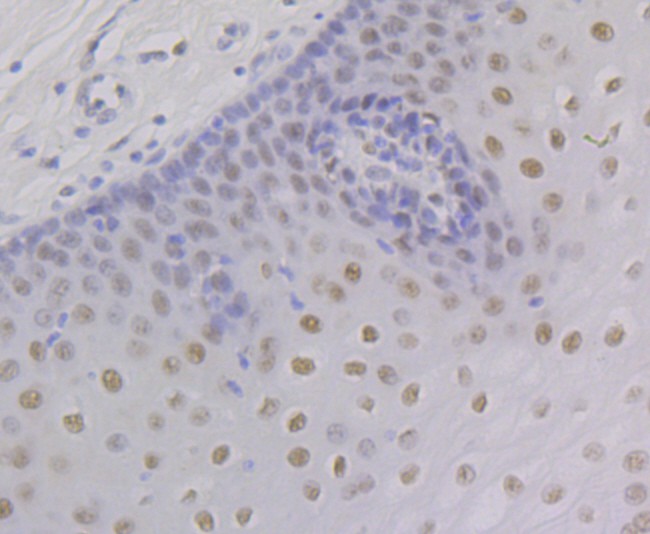 Immunohistochemical analysis of paraffin-embedded human esophagus tissue using anti-Retinoid X Receptor alpha antibody. The section was pre-treated using heat mediated antigen retrieval with Tris-EDTA buffer (pH 8.0-8.4) for 20 minutes.The tissues were blocked in 5% BSA for 30 minutes at room temperature, washed with ddH2O and PBS, and then probed with the primary antibody (ET7108-99, 1/50) for 30 minutes at room temperature. The detection was performed using an HRP conjugated compact polymer system. DAB was used as the chromogen. Tissues were counterstained with hematoxylin and mounted with DPX.
