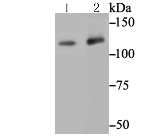 Western blot analysis of MGEA5 on different lysates. Proteins were transferred to a PVDF membrane and blocked with 5% BSA in PBS for 1 hour at room temperature. The primary antibody (ET7109-01, 1/500) was used in 5% BSA at room temperature for 2 hours. Goat Anti-Rabbit IgG - HRP Secondary Antibody (HA1001) at 1:200,000 dilution was used for 1 hour at room temperature.<br />
Positive control: <br />
Lane 1: PC-3M cell lysate<br />
Lane 2: SH-SY5Y cell lysate