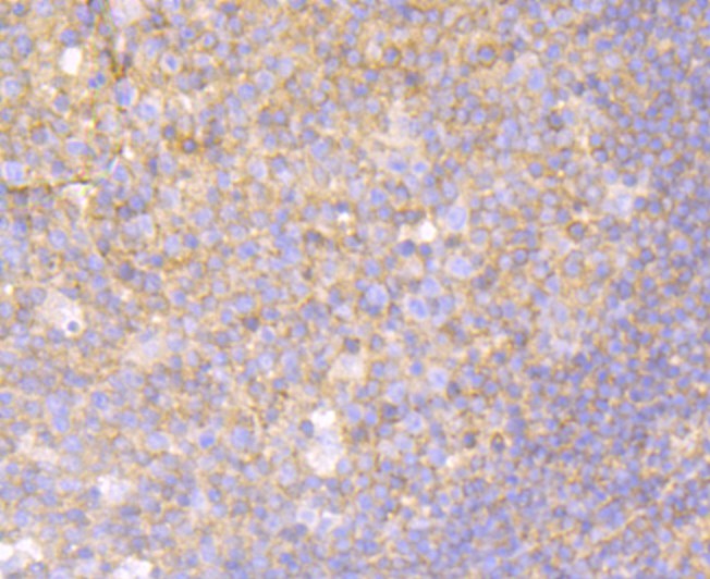 Immunohistochemical analysis of paraffin-embedded human tonsil tissue using anti-MGEA5 antibody. The section was pre-treated using heat mediated antigen retrieval with Tris-EDTA buffer (pH 8.0-8.4) for 20 minutes.The tissues were blocked in 5% BSA for 30 minutes at room temperature, washed with ddH2O and PBS, and then probed with the primary antibody (ET7109-01, 1/50) for 30 minutes at room temperature. The detection was performed using an HRP conjugated compact polymer system. DAB was used as the chromogen. Tissues were counterstained with hematoxylin and mounted with DPX.