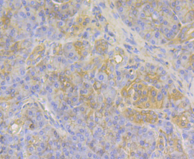 Immunohistochemical analysis of paraffin-embedded human pancreas tissue using anti-MGEA5 antibody. The section was pre-treated using heat mediated antigen retrieval with Tris-EDTA buffer (pH 8.0-8.4) for 20 minutes.The tissues were blocked in 5% BSA for 30 minutes at room temperature, washed with ddH2O and PBS, and then probed with the primary antibody (ET7109-01, 1/50) for 30 minutes at room temperature. The detection was performed using an HRP conjugated compact polymer system. DAB was used as the chromogen. Tissues were counterstained with hematoxylin and mounted with DPX.
